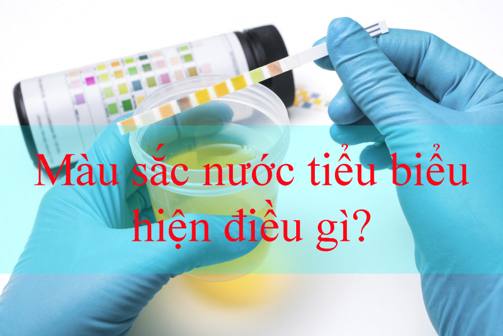 Màu sắc nước tiểu